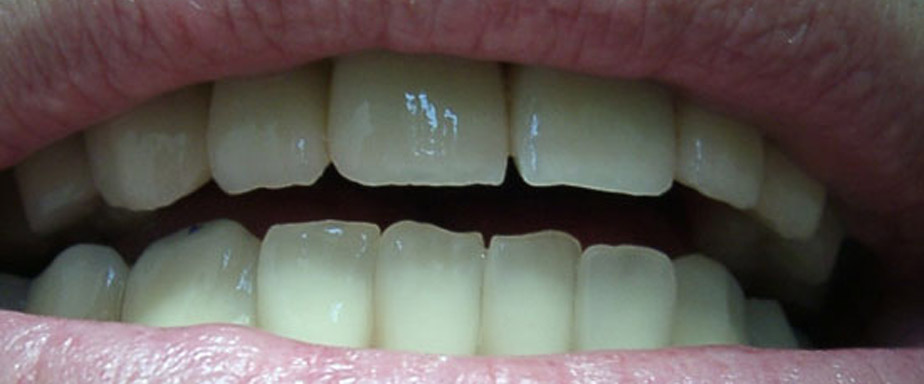 slide-1 Ästhetische Zahnheilkunde