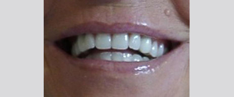 slide-2 Ästhetische Zahnheilkunde