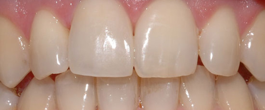 slide-3 Ästhetische Zahnheilkunde